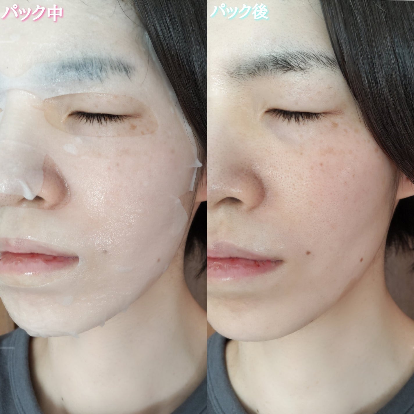 マデカソサイドブレミッシュリペアセラム/MEDIHEAL/美容液を使ったクチコミ(4枚目)