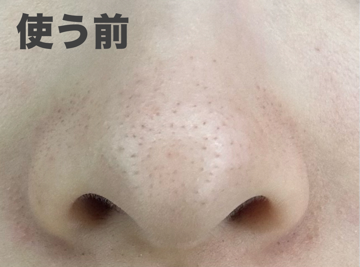 ノーモアブラックヘッド(ノーズピーリング)/One-day's you/スクラブ・ゴマージュを使ったクチコミ（2枚目）