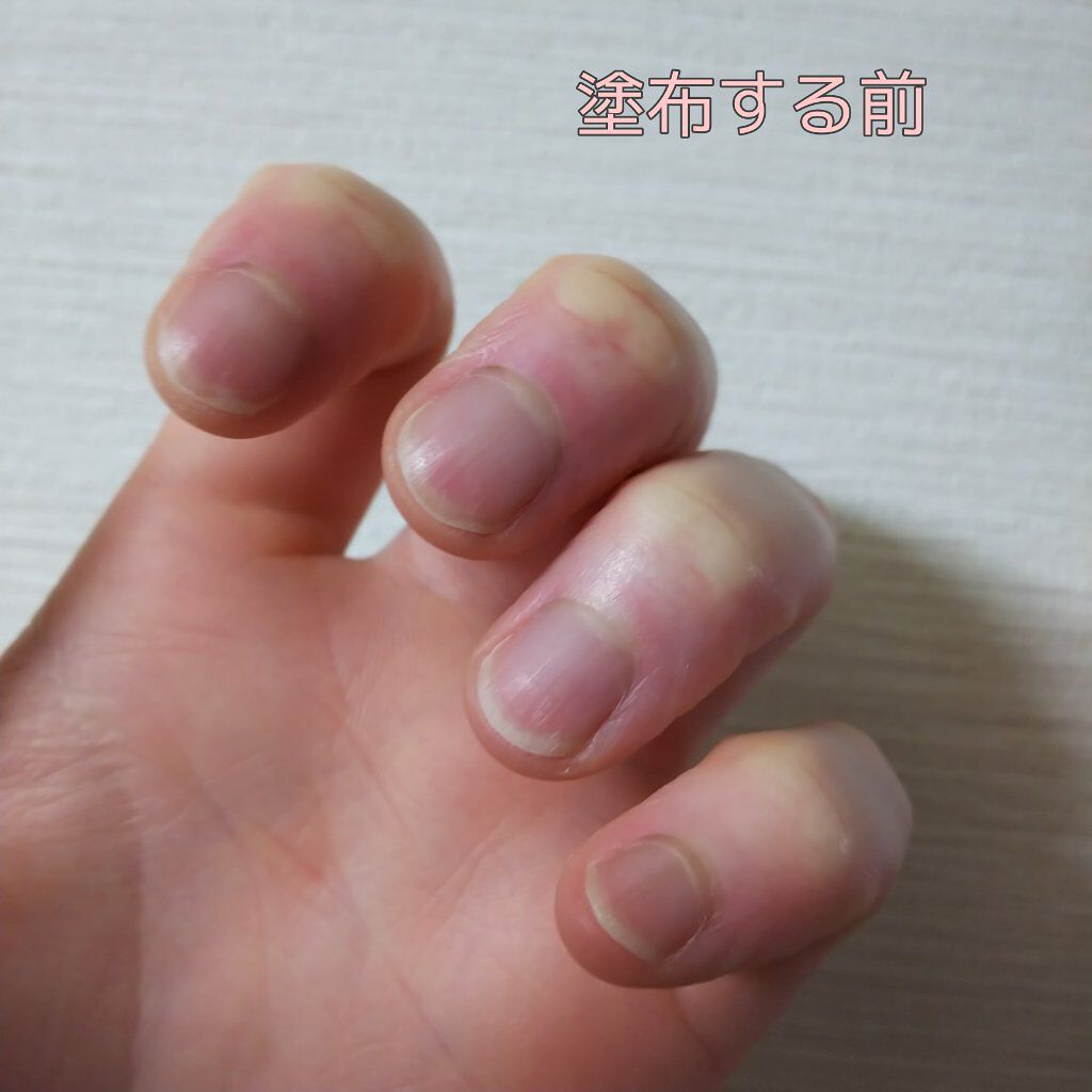 エテュセ クイックケアコート/ettusais/ネイルオイル・トリートメントを使ったクチコミ（2枚目）