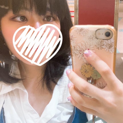 りんごあめ on LIPS 「先日、二重整形の埋没法の施術を受けてから1年が経過しました🙌✨..」(6枚目)