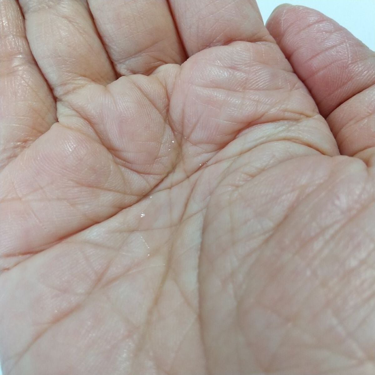 エファクラ ピールケア セラム/ラ ロッシュ ポゼ/美容液を使ったクチコミ(2枚目)