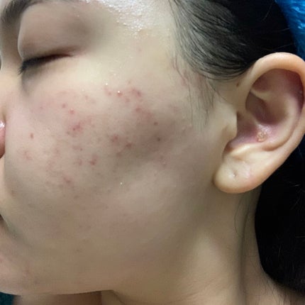 ティーツリーケア ソリューション エッセンシャルマスクEX/MEDIHEAL/シートマスク・パックを使ったクチコミ(2枚目)