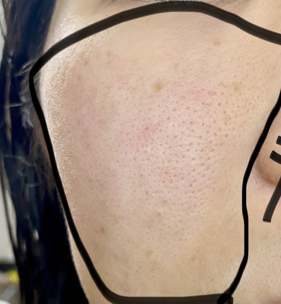 オバジC20セラム/オバジ/美容液を使ったクチコミ（1枚目）