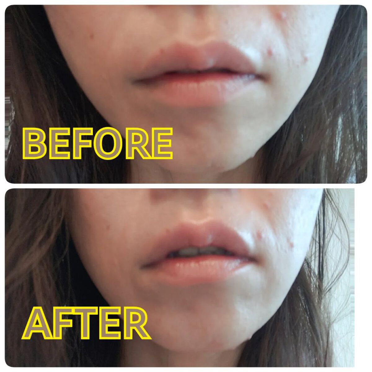 RJビーリップ/アピセラピーコスメティクス/リップクリームを使ったクチコミ（2枚目）