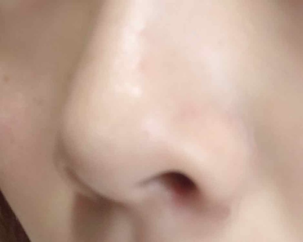 ジョンソン ベビーパウダー/ジョンソンベビー/ボディパウダーを使ったクチコミ(3枚目)