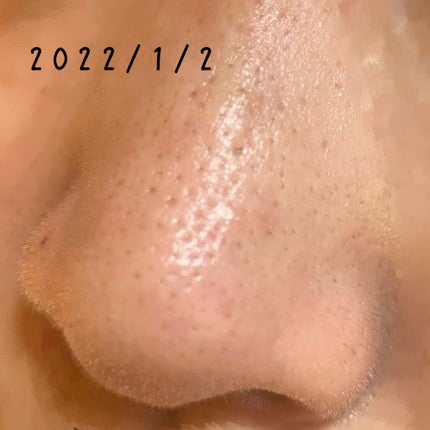 モイスチュア リポソーム/DECORTÉ/美容液を使ったクチコミ(4枚目)