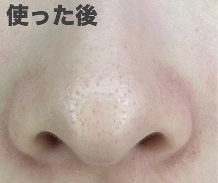 ノーモアブラックヘッド(ノーズピーリング)/One-day's you/スクラブ・ゴマージュを使ったクチコミ(5枚目)