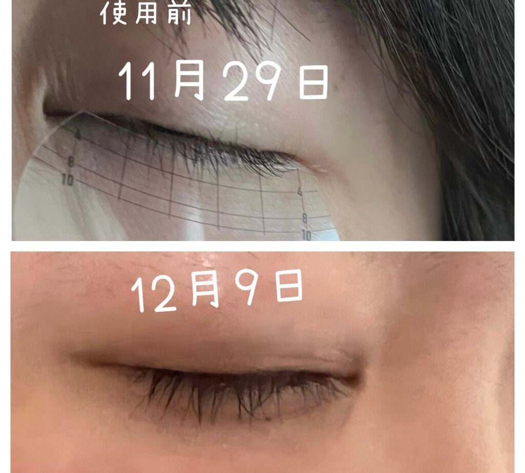 エターナルアイラッシュ/リュバンブラン/まつげ美容液を使ったクチコミ(1枚目)