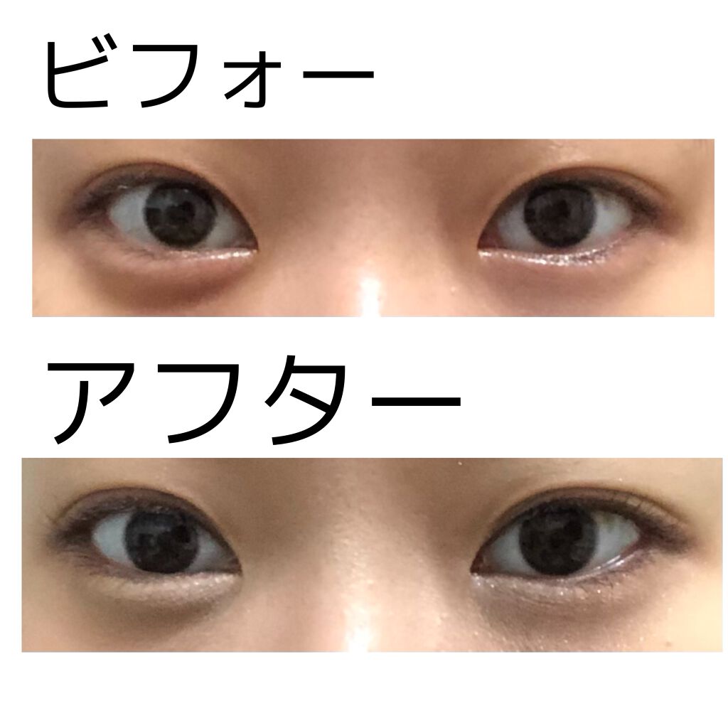 ハイブリッドフィルム スーパーマット/アイトーク/二重まぶた用アイテムを使ったクチコミ(4枚目)