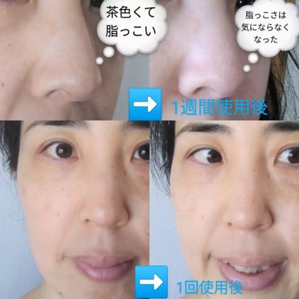 ホワイトニング ブラック マスク/B/H COLLECT/洗い流すパック・マスクを使ったクチコミ(2枚目)