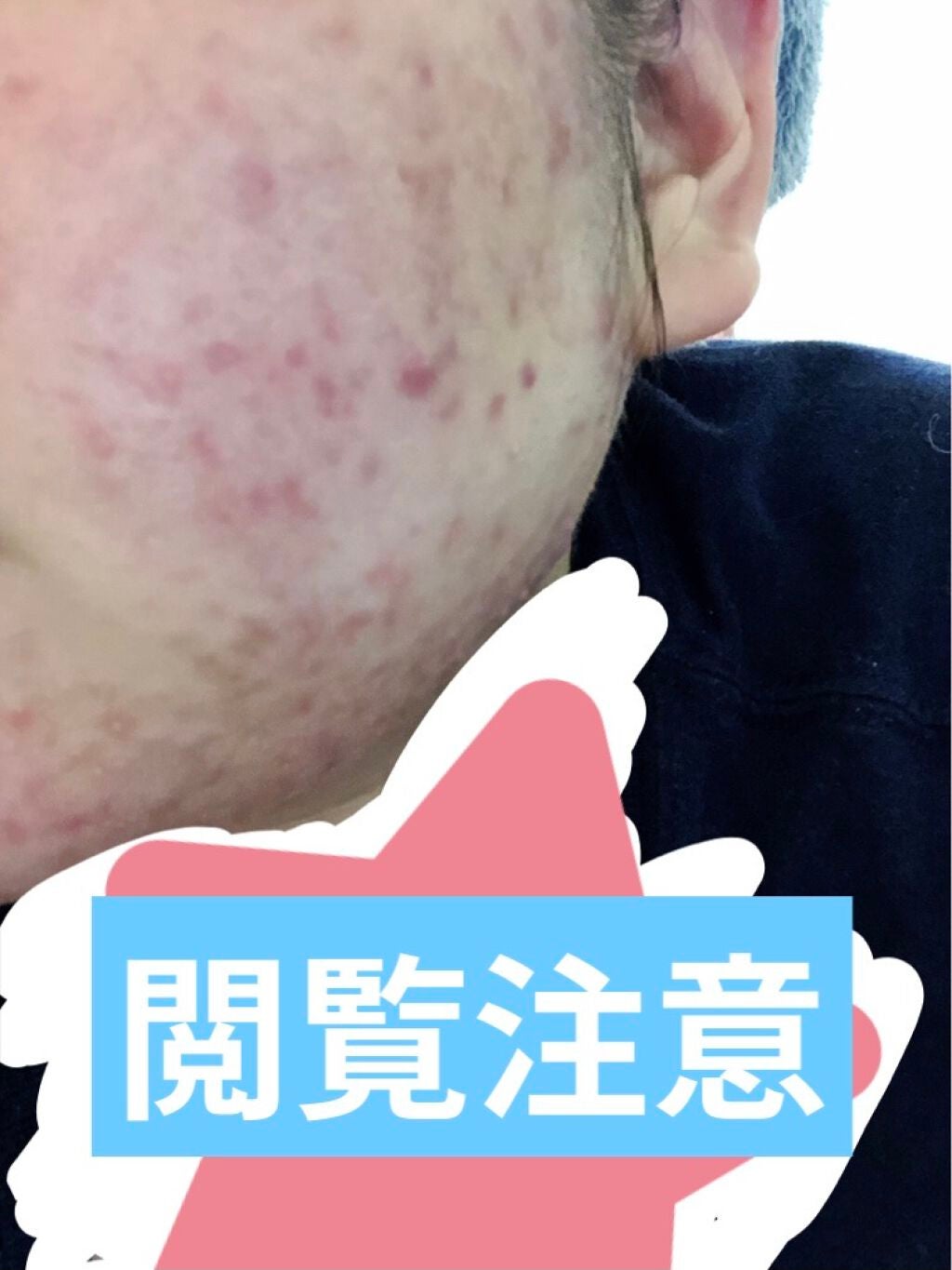 あさみん on LIPS 「自分の過去を見つめ直す時間になってる😂中学生から25歳くらいま..」(1枚目)