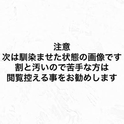 毛穴小町 酵素クレンジングオイル/ソフティモ/オイルクレンジングを使ったクチコミ(4枚目)