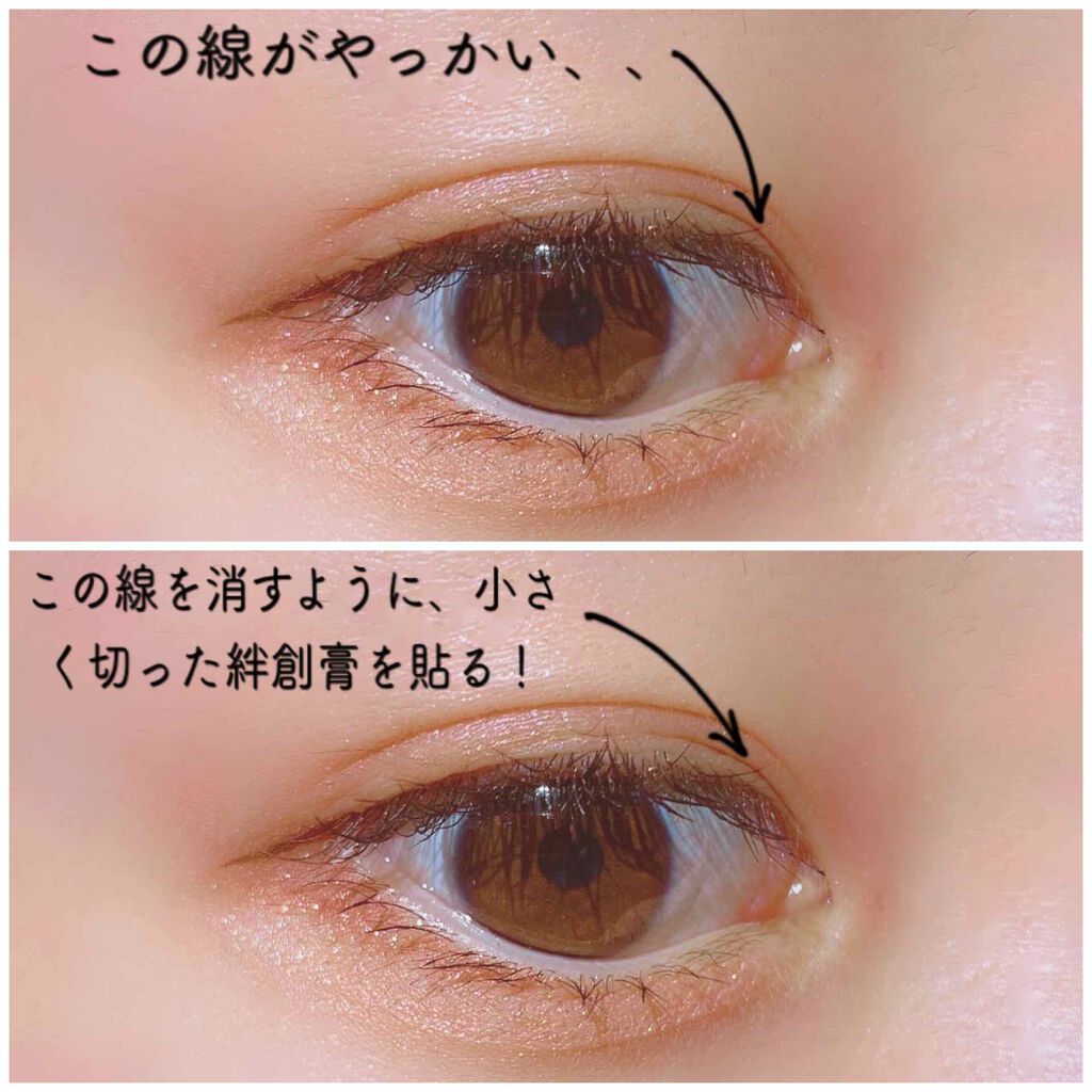 肌色タイプ/バンドエイド/その他を使ったクチコミ（3枚目）