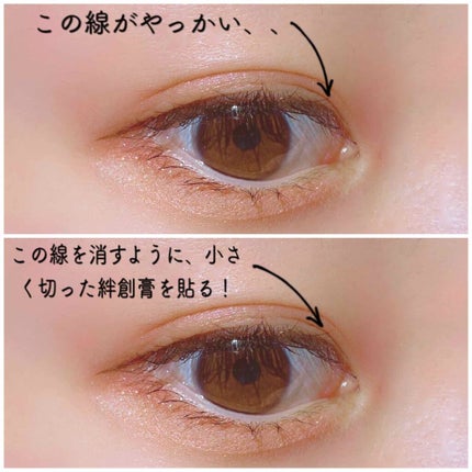 肌色タイプ/バンドエイド/その他を使ったクチコミ(3枚目)