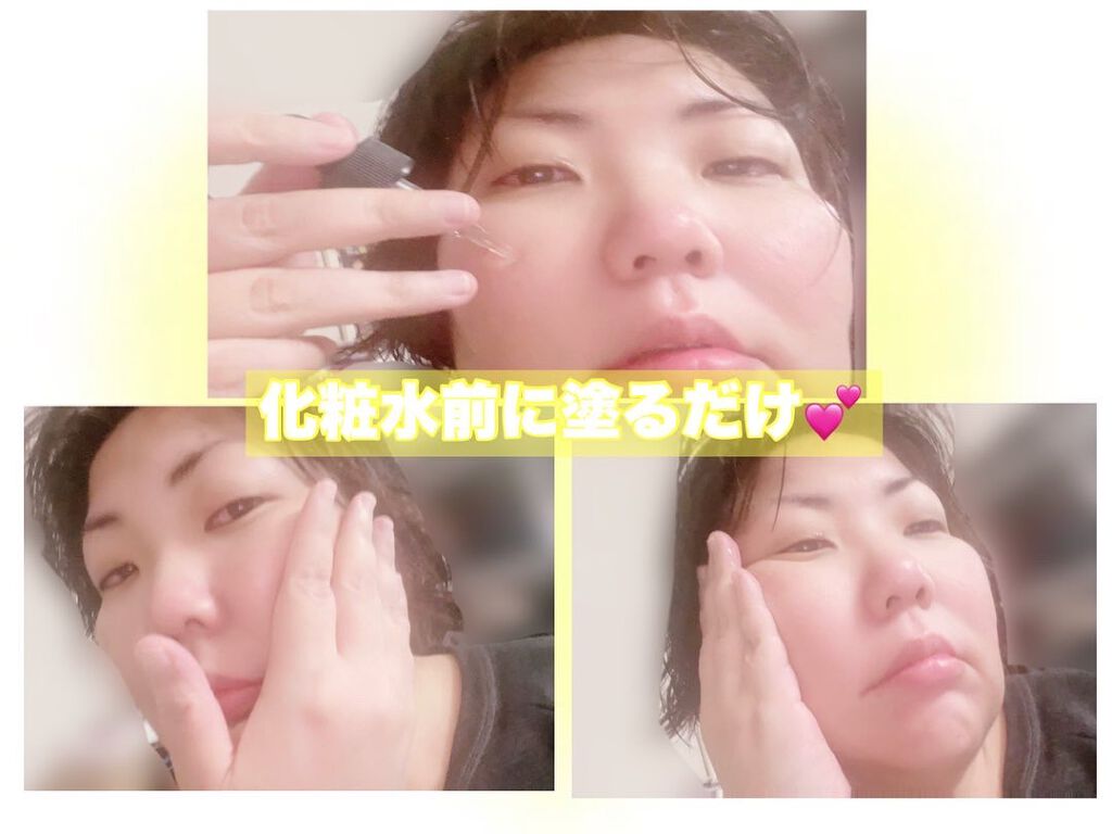 Cエッセンス/EBiS化粧品/美容液を使ったクチコミ（3枚目）