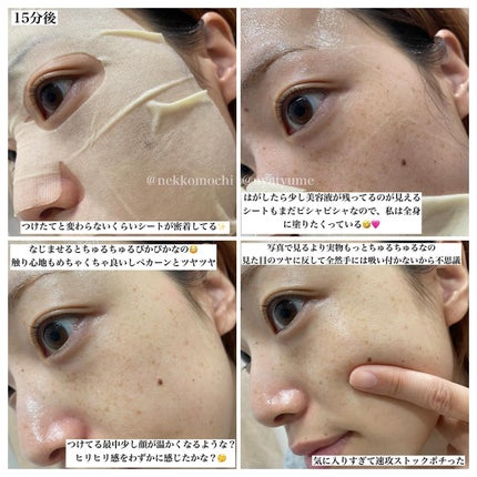 8デイズピュアビタミンCアンプル/VARI:HOPE/美容液を使ったクチコミ(6枚目)