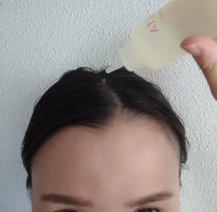 ベルタ ヘアローション/BELTA(ベルタ)/頭皮ローションを使ったクチコミ(2枚目)