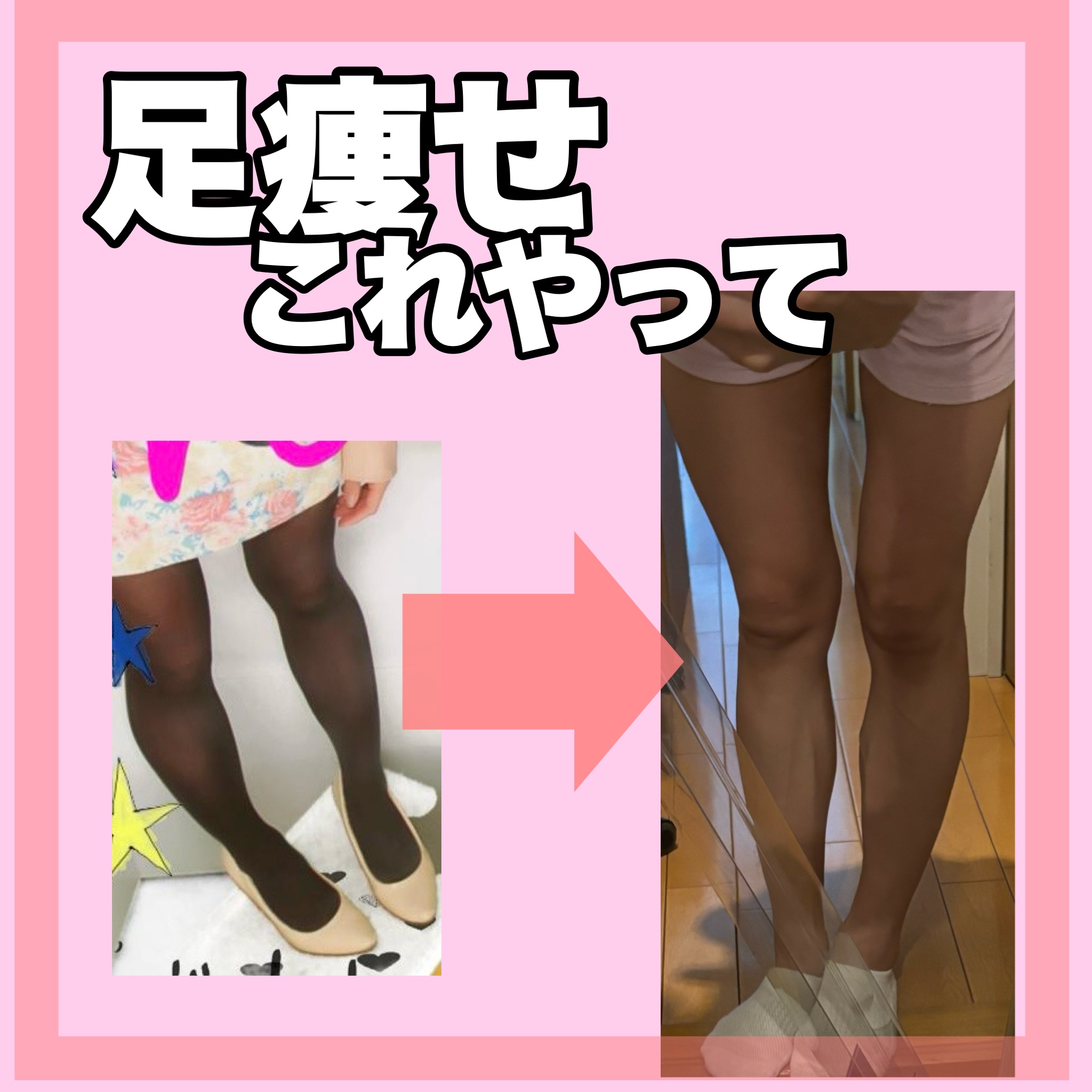 ジョンソン ベビーオイル 無香料/ジョンソンベビー/ボディオイルを使ったクチコミ（1枚目）