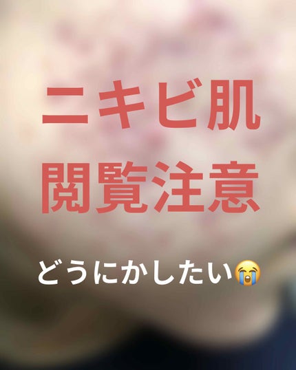 アルビオン 薬用スキンコンディショナー エッセンシャル/ALBION/化粧水を使ったクチコミ(1枚目)