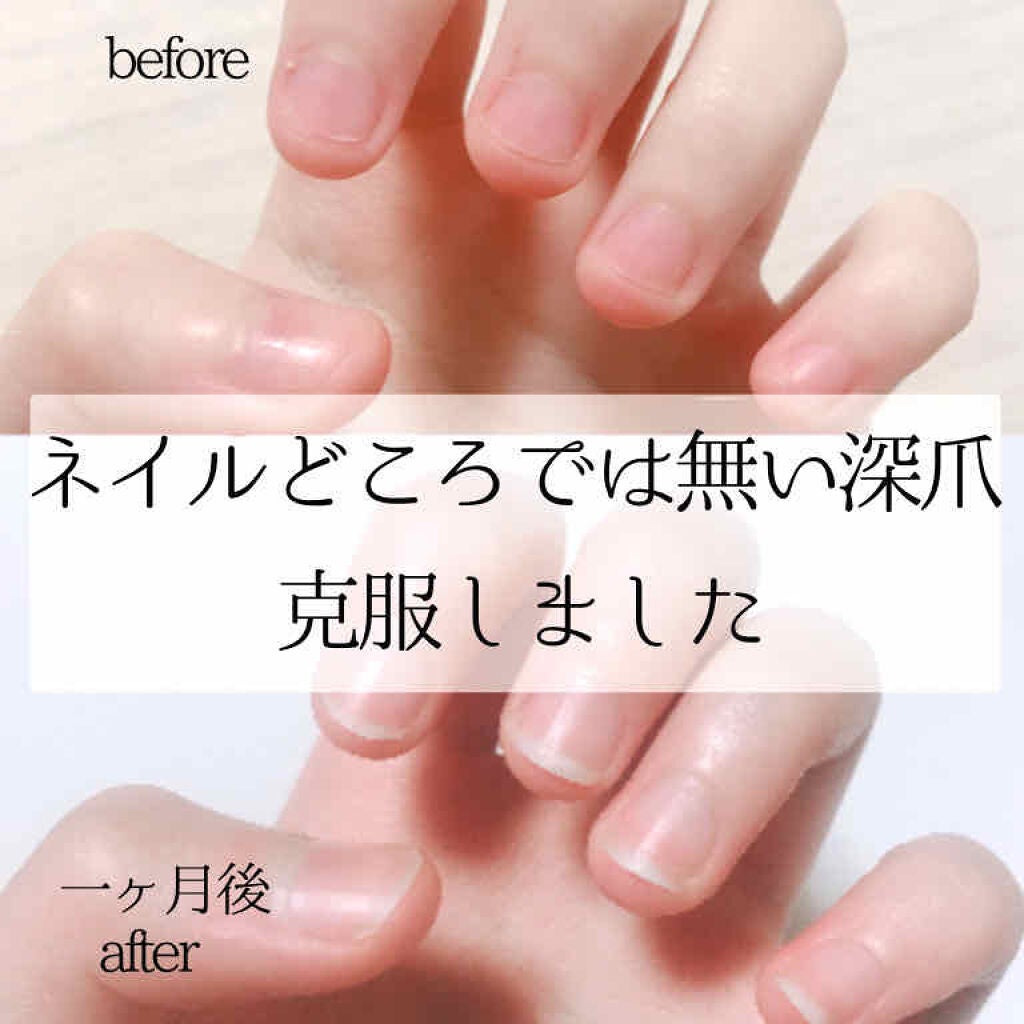 デイケアオイル/Dr.Nail/ネイルオイル・トリートメントを使ったクチコミ(1枚目)