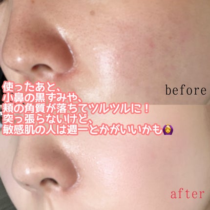 フェイスポリッシャー リフレッシング(ミント)/SABON/スクラブ・ゴマージュを使ったクチコミ(3枚目)