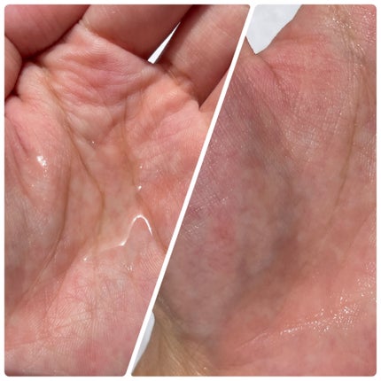 センテラ トーニングトナー/SKIN1004/化粧水を使ったクチコミ(2枚目)