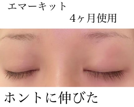 EMAKED(エマーキット)/水橋保寿堂製薬/まつげ美容液を使ったクチコミ(1枚目)