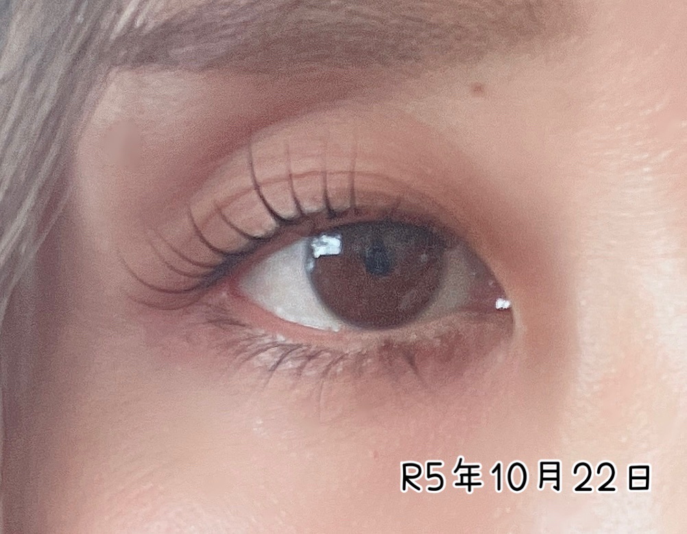 ナチュラルアイビュー/MYM/美容液を使ったクチコミ（3枚目）