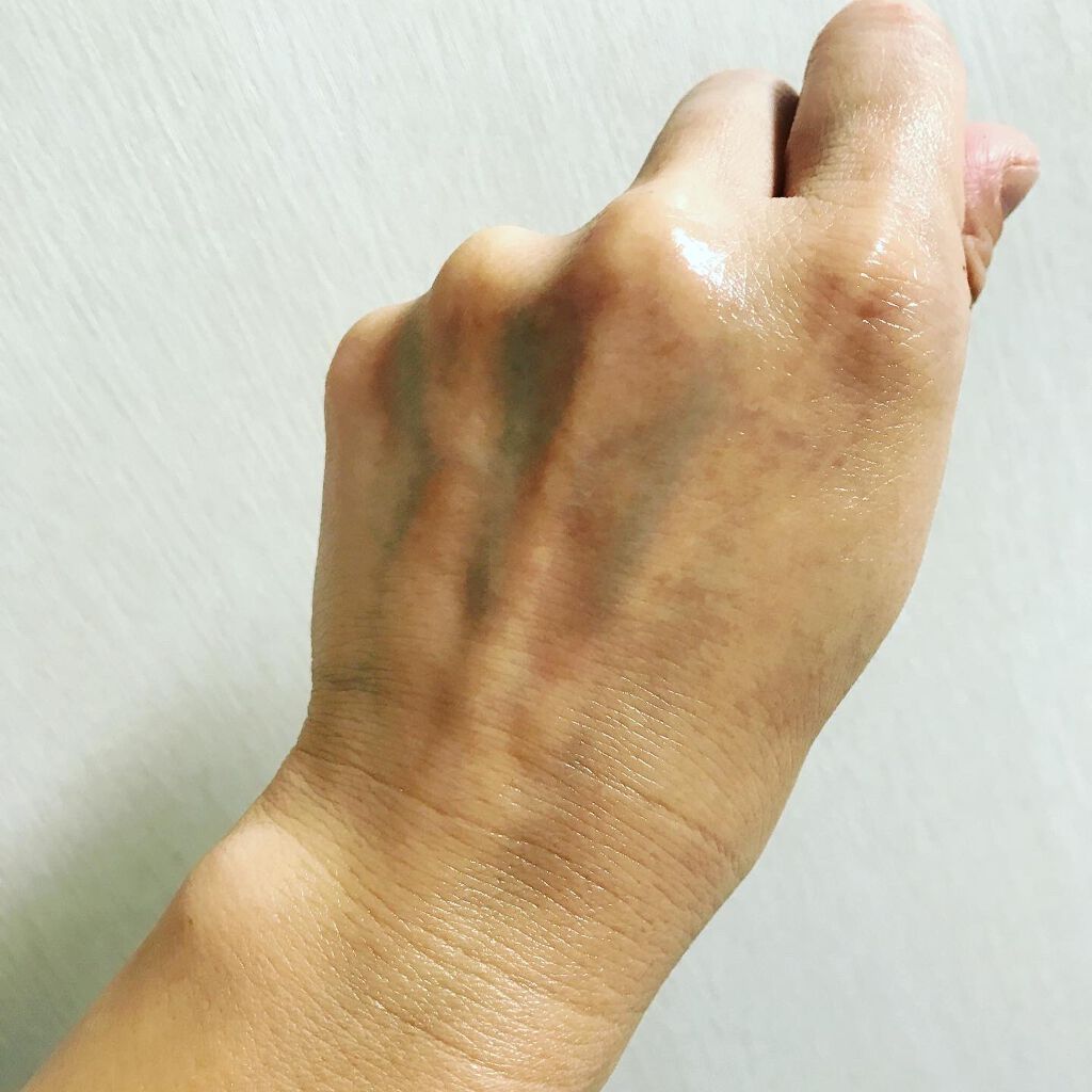 バイオイル/バイオイル/フェイスオイルを使ったクチコミ(6枚目)