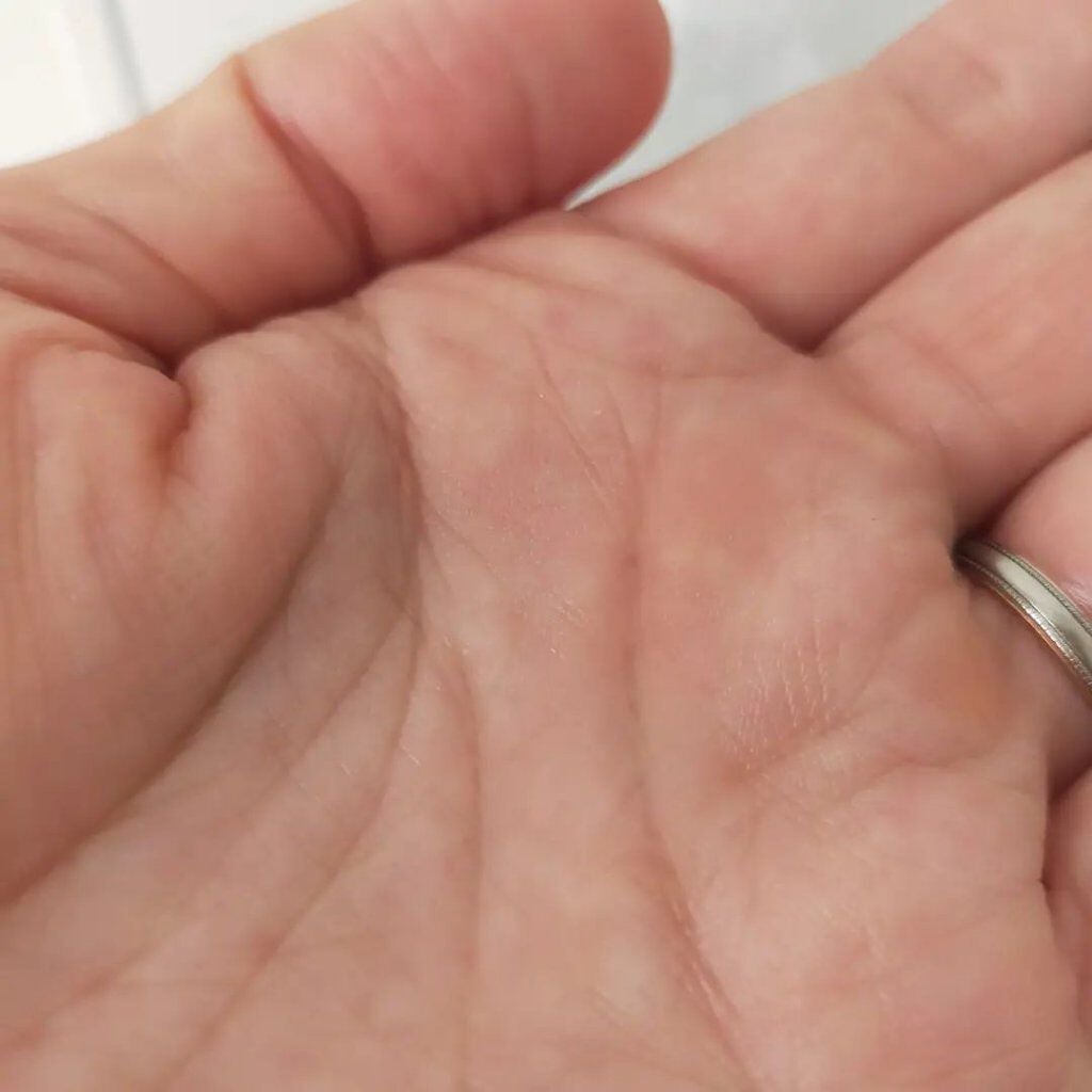 chohoho_s on LIPS 「セルエフ ドライケアメディカライザーライン使いで紹介します。ま..」(4枚目)