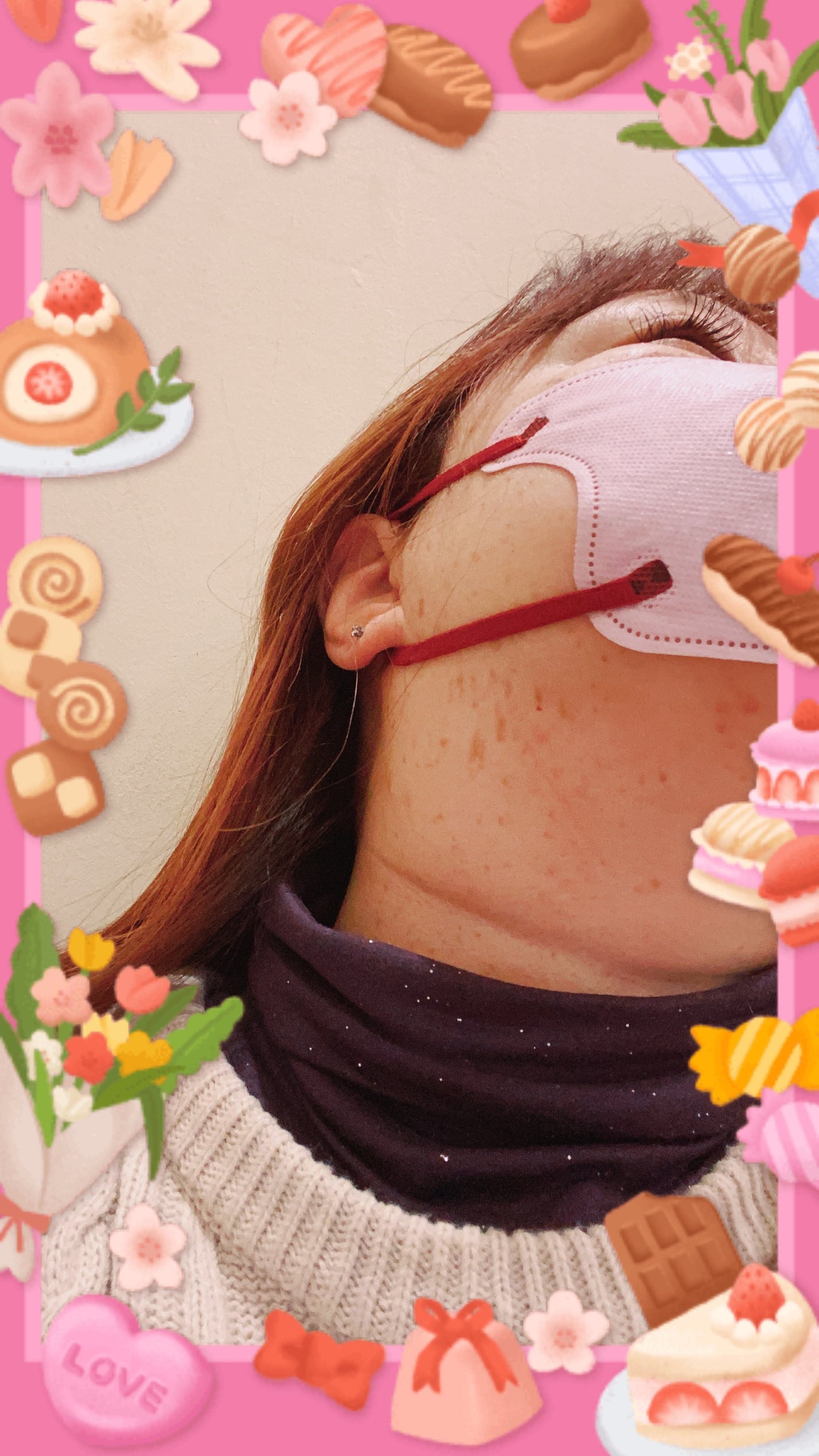 リサ・ラーソン♡クッションファンデマニア on LIPS 「#イボ#シミ取り#ビフォー..」(1枚目)