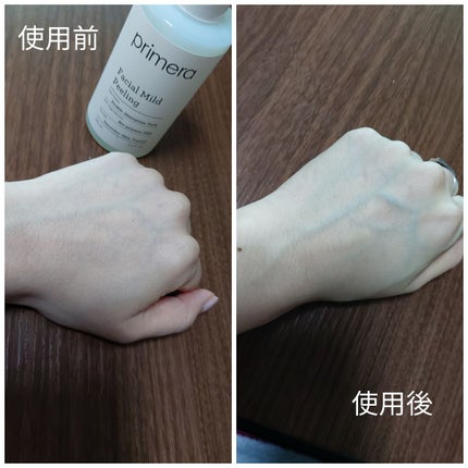 フェイシャルマイルドピーリング/primera/ピーリングを使ったクチコミ(3枚目)