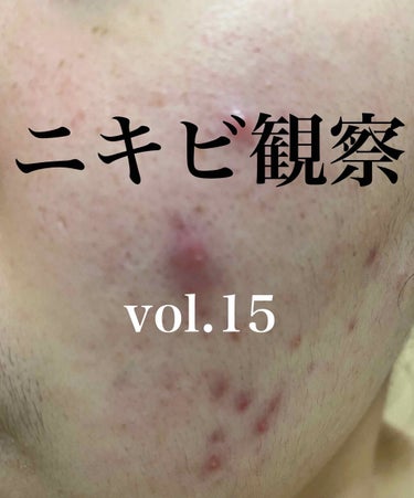 敏感肌用薬用美白美容液/無印良品/美容液を使ったクチコミ（1枚目）