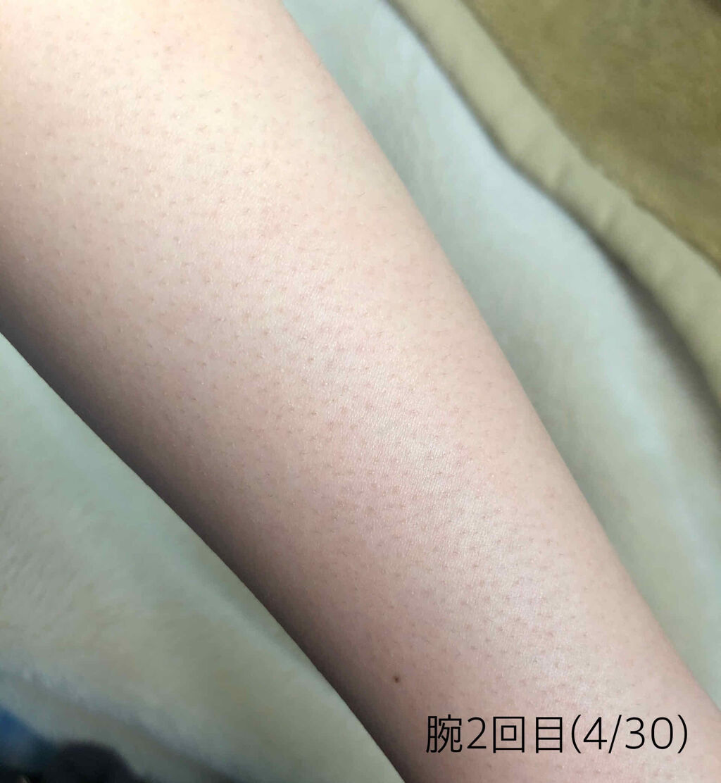 光美容器KE-NON（ケノン）/エムテック/家庭用脱毛器を使ったクチコミ（3枚目）