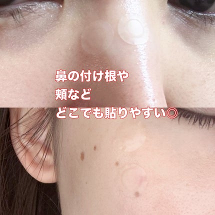 Dr.G Aクリアスポットパッチ/Dr.G/その他スキンケアを使ったクチコミ(5枚目)