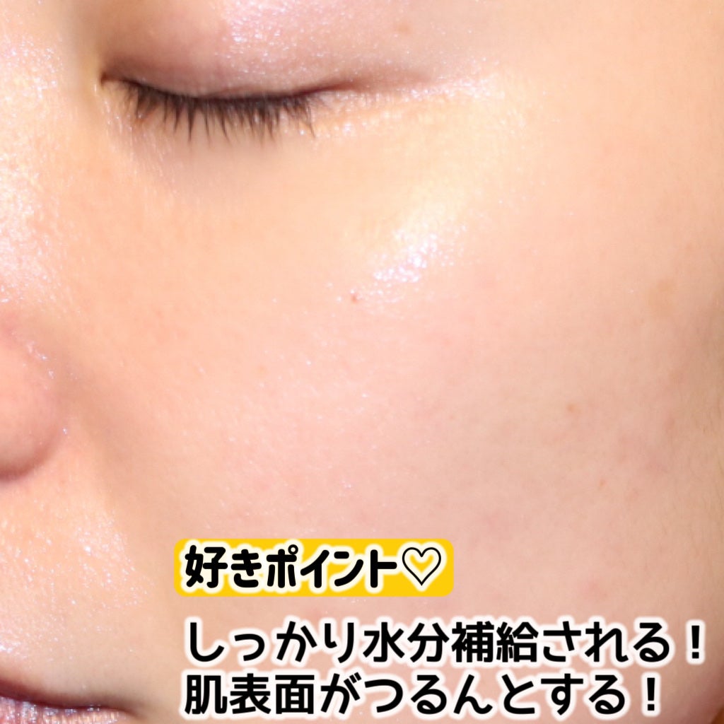 レチビタエッセンスマスク/ピュレア/シートマスク・パックを使ったクチコミ(6枚目)