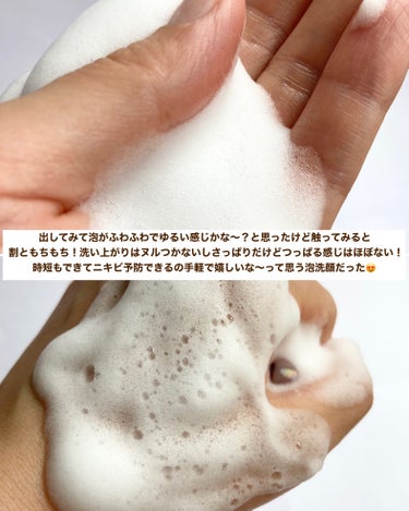 薬用泡のふんわり洗顔/スキンライフ/泡洗顔を使ったクチコミ（5枚目）