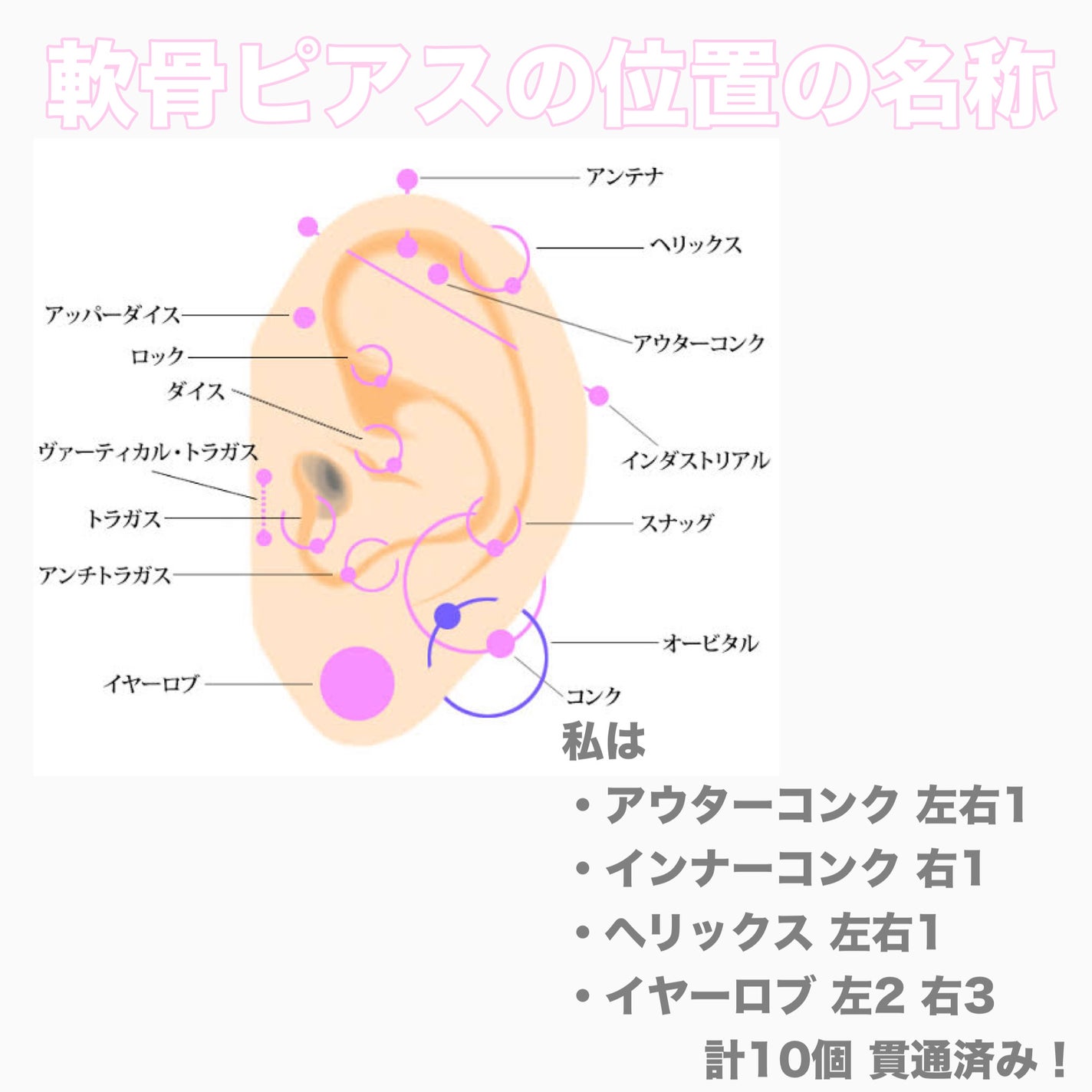 テラマイシン 軟膏(医薬品)/ジョンソン・エンド・ジョンソン/その他を使ったクチコミ(2枚目)