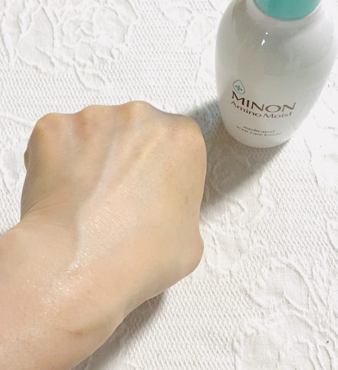 ミノン アミノモイスト 薬用アクネケア ローション/ミノン/化粧水を使ったクチコミ（3枚目）
