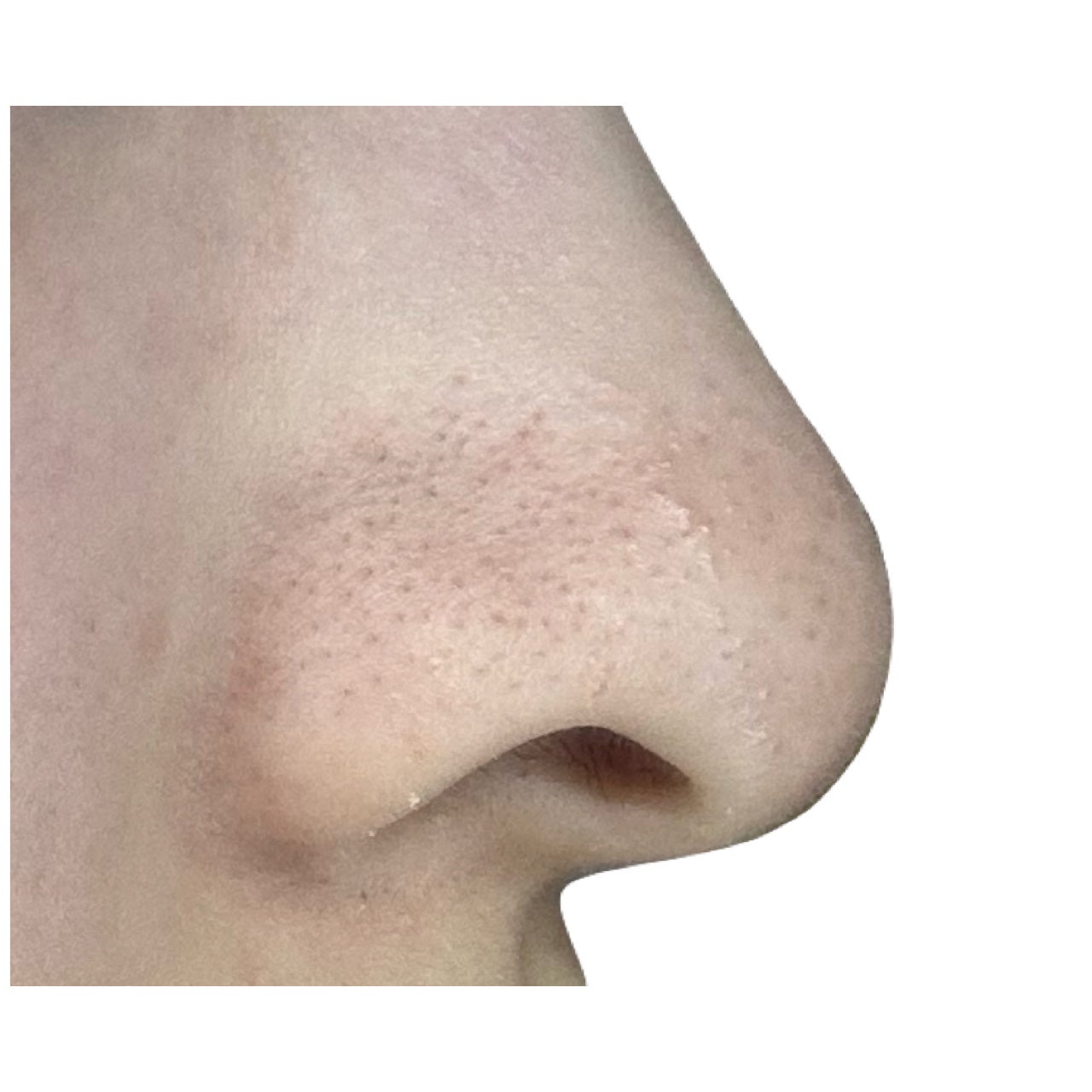 アンドハニー クレンジングバーム ブラック/&honey/クレンジングバームを使ったクチコミ(6枚目)