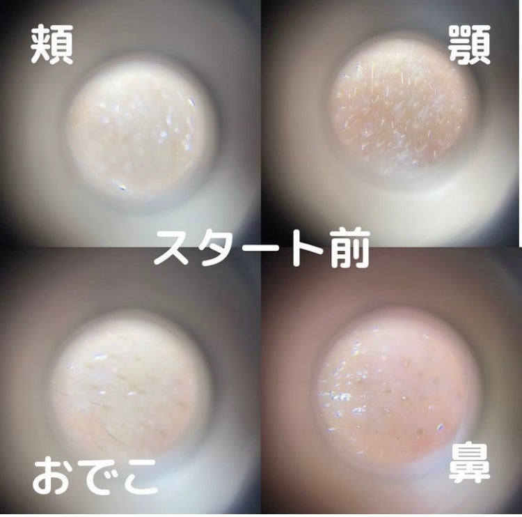 リードルショット100/VT/美容液を使ったクチコミ(7枚目)