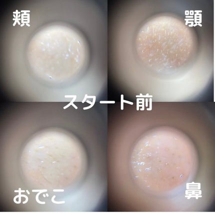 リードルショット100/VT/美容液を使ったクチコミ(7枚目)