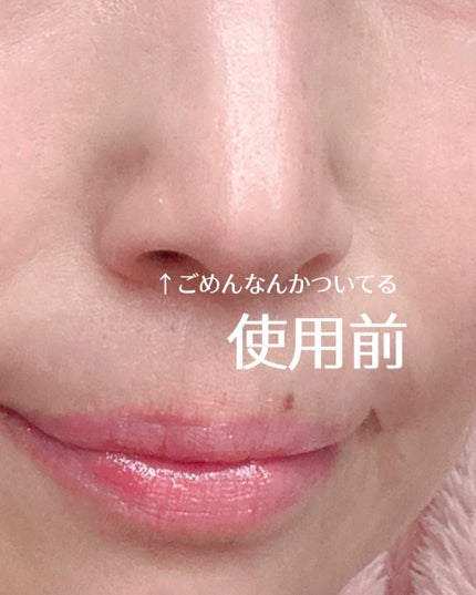 ナチュラルマイルドクリアノーズパック/ilso/シートマスク・パックを使ったクチコミ(5枚目)