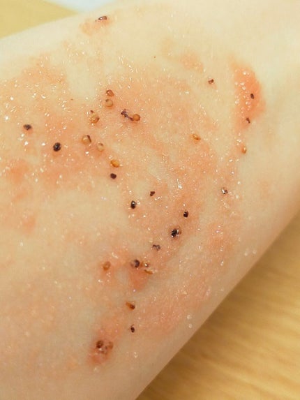 ストロベリーシュガー フードマスク/SKINFOOD/洗い流すパック・マスクを使ったクチコミ(4枚目)