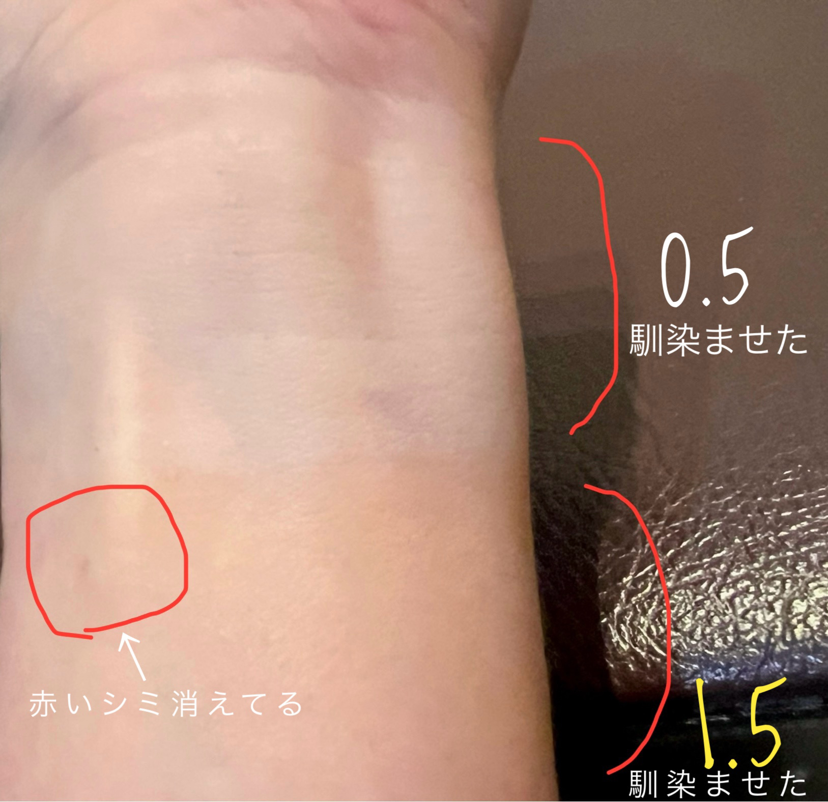 ダーマシンコンシーラー/23years old/リキッドコンシーラーを使ったクチコミ（3枚目）