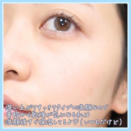 世界の果実 すっきり泡洗顔/世界の果実/泡洗顔を使ったクチコミ(5枚目)