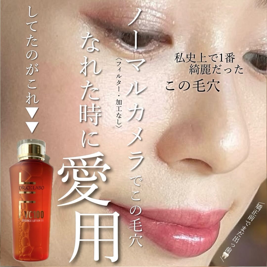 VC100エッセンスローション EX/ドクターシーラボⓇ/化粧水を使ったクチコミ（1枚目）