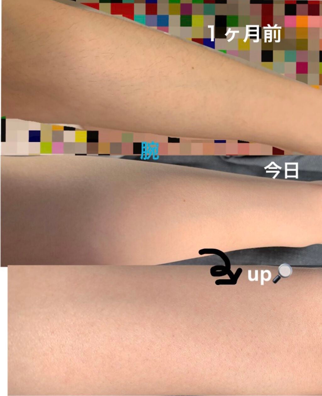 光脱毛器 VIO/Sarlisi/家庭用脱毛器を使ったクチコミ(3枚目)