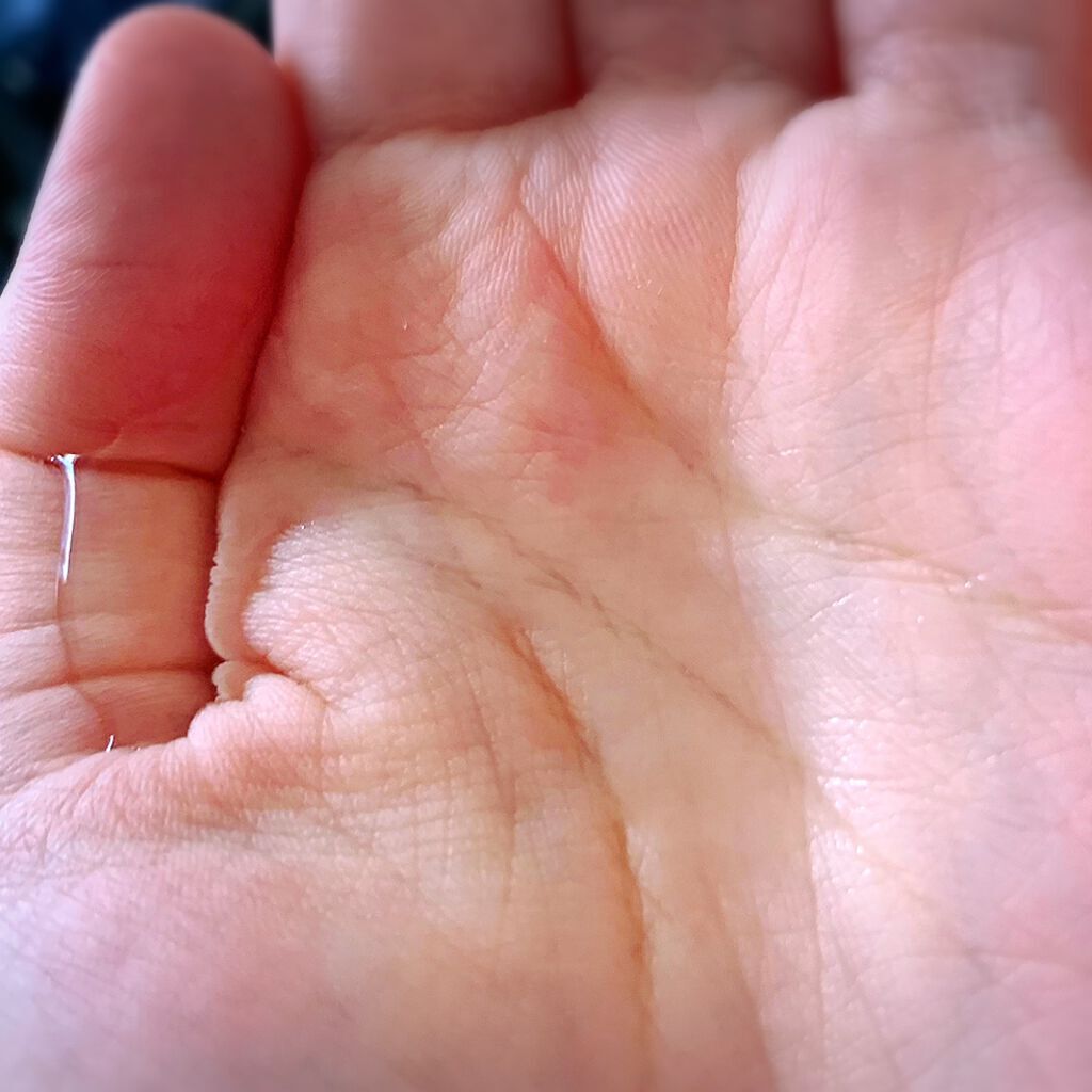 ☆scallop☆フォロバ100%☆ on LIPS 「ヒト幹細胞培養エキス配合の化粧水を使ってみました!敏感肌も安心..」(3枚目)