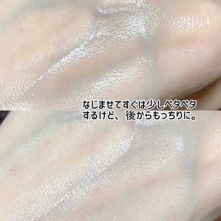 ヒアルロン酸化粧水/ONE THING/化粧水を使ったクチコミ(3枚目)